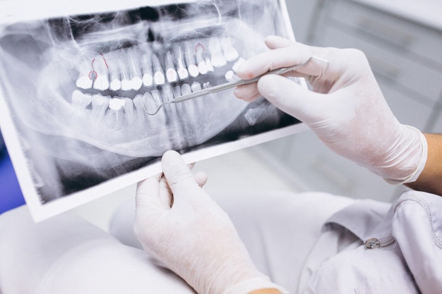 endodonzia dentale