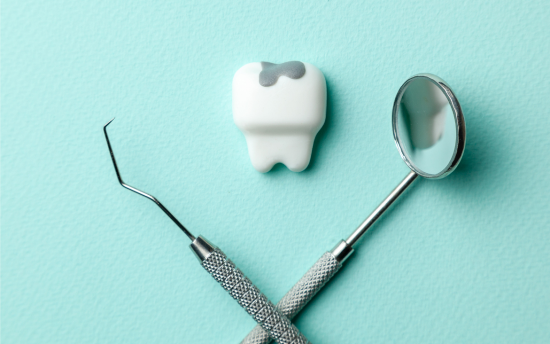 Come riconoscere una carie dentale e come curarla