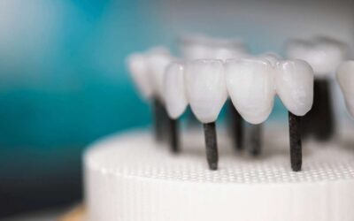Zirconia dentale: per quali lavorazioni viene utilizzata