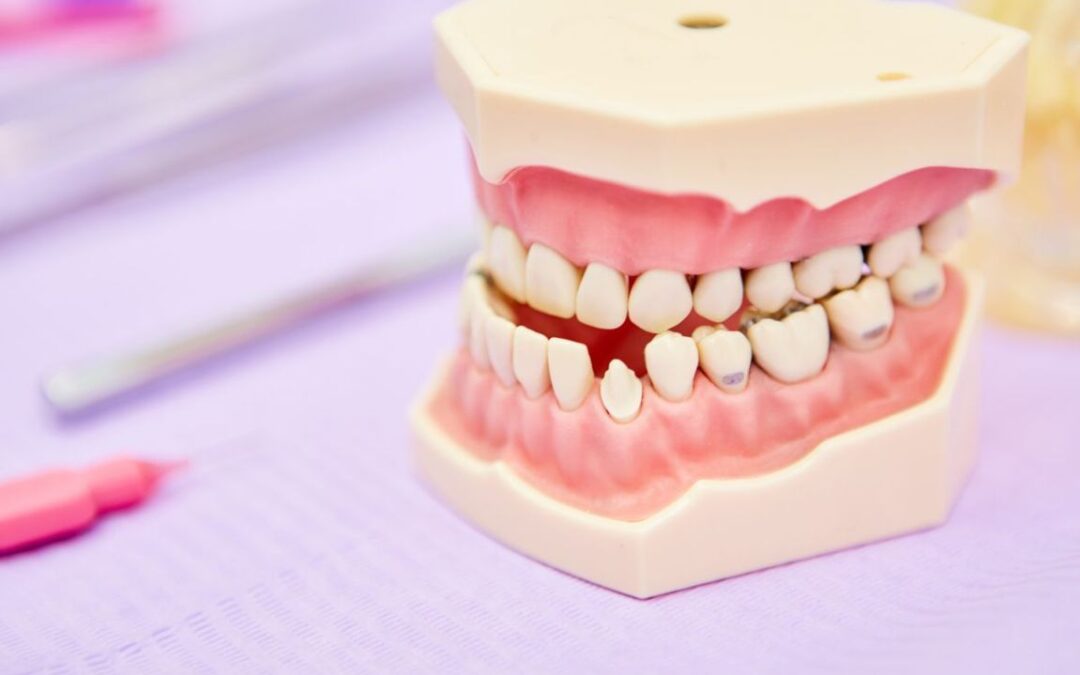 problemi di malocclusione dentale